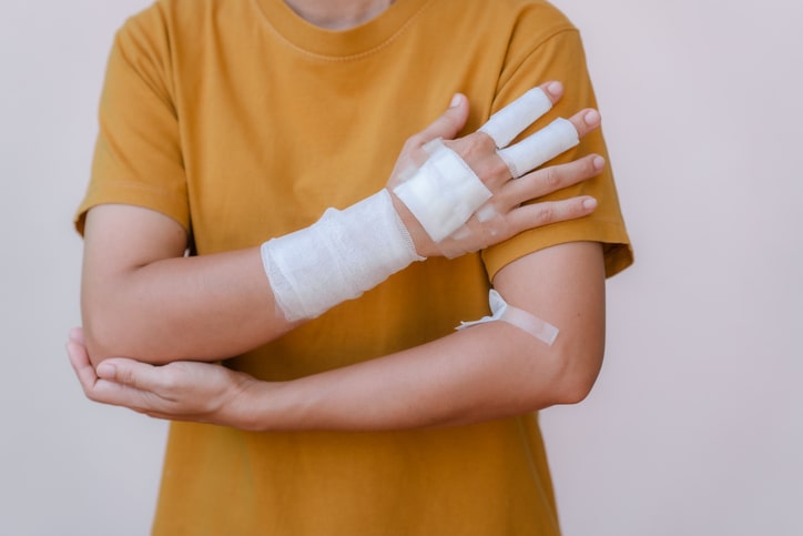 Burn Injury Law in Portsmouth, New Hampshire
