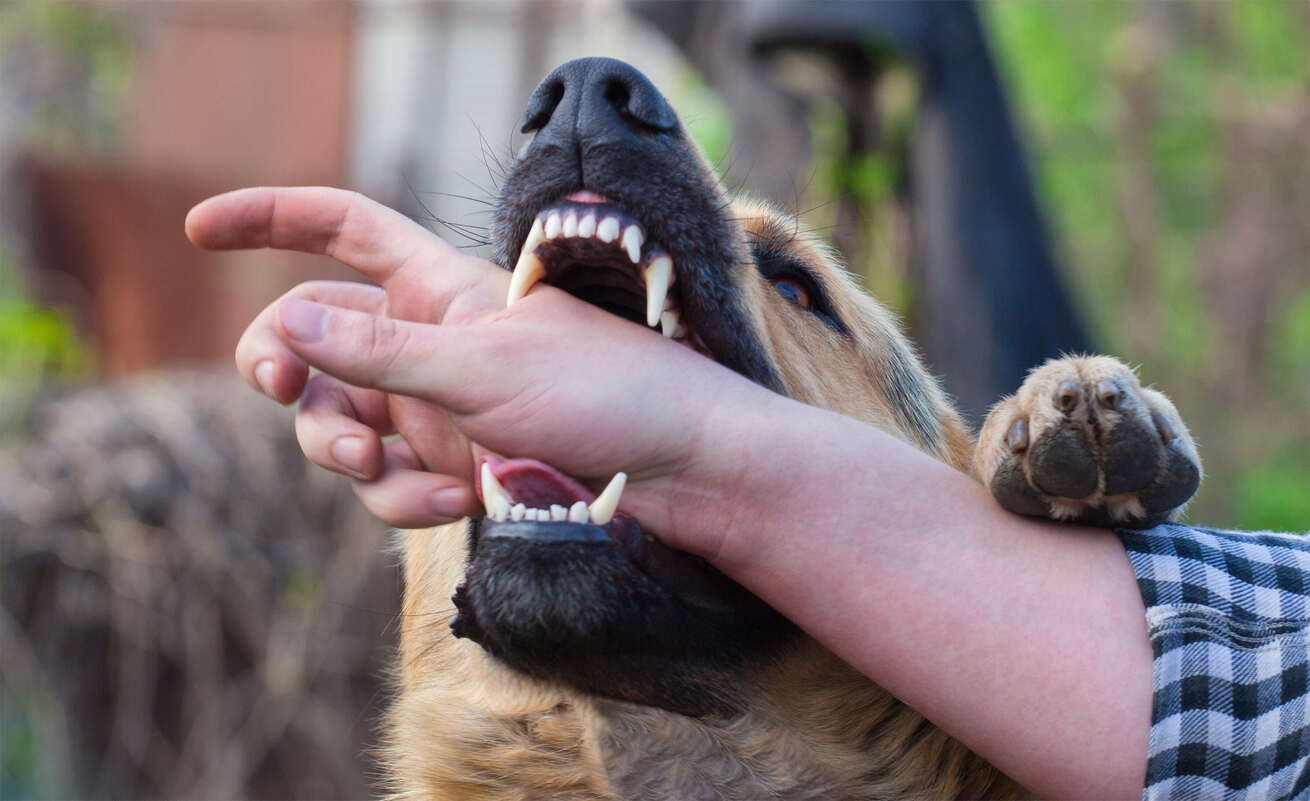 The image shows a dog biting a person's hand, emphasizing the danger of dog bite incidents.