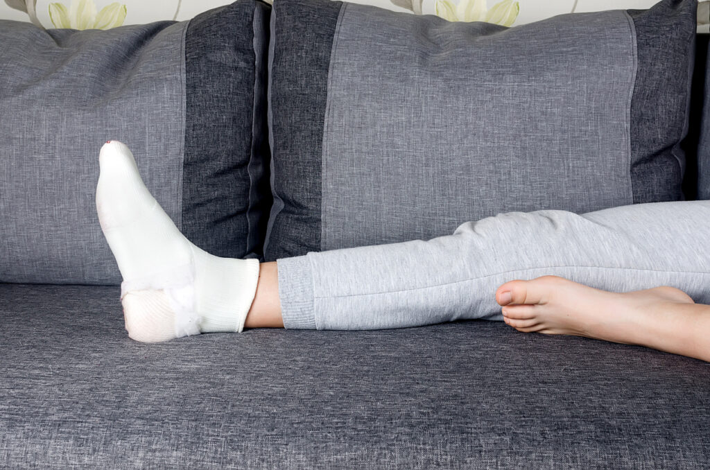 Close up of a leg young girl fiberglass.